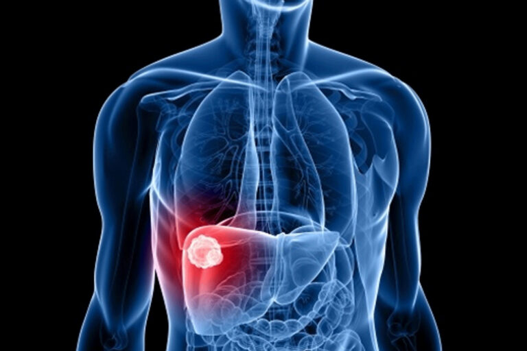 bb6becbd-2276-4a27-b140-098fa1fe1f61